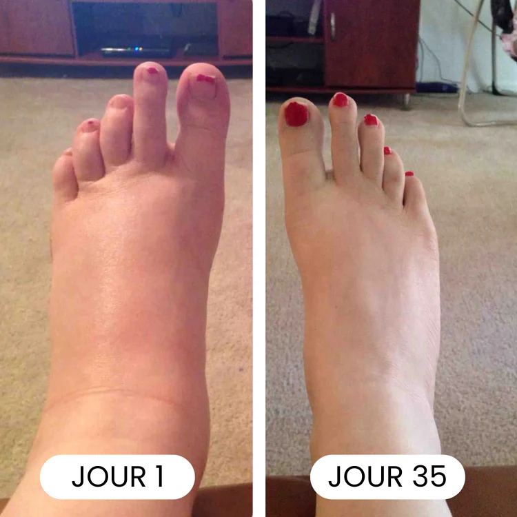 Gouttes de bien-être pour le drainage lymphatique